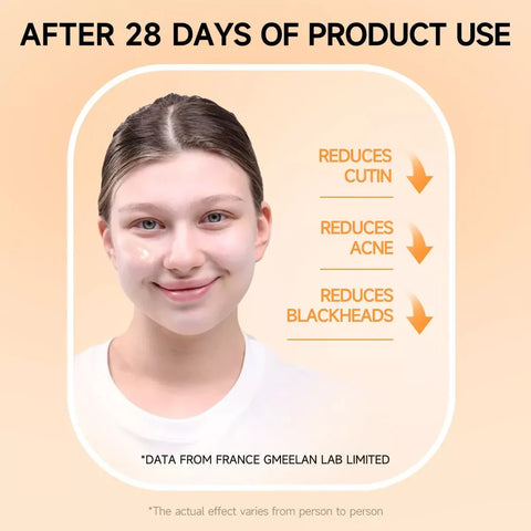 Orange Enzymes Exfoliating Brightening Gel – Gentle Dead Skin Remover for Glowing Skin