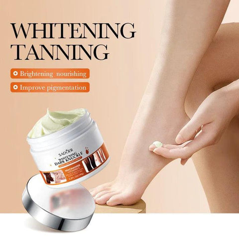 Sadoer 7 Days Whitening Dark Knuckle Cream 140g – Moisturizing Cream for Dark Knuckles, Elbows & Knees