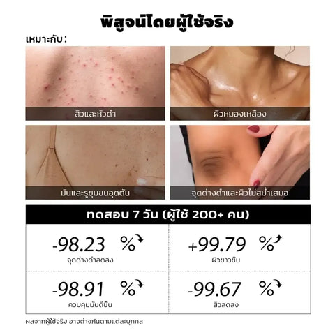 Teashell Niacinamide Skin Brightening Soap melasma dark spots freckle