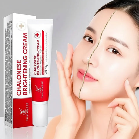 CHALONESE Brightening Cream Serum 20g – Skin Brightening & Dark Spot Correcting Cream