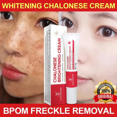 CHALONESE Brightening Cream Serum 20g – Skin Brightening & Dark Spot Correcting Cream